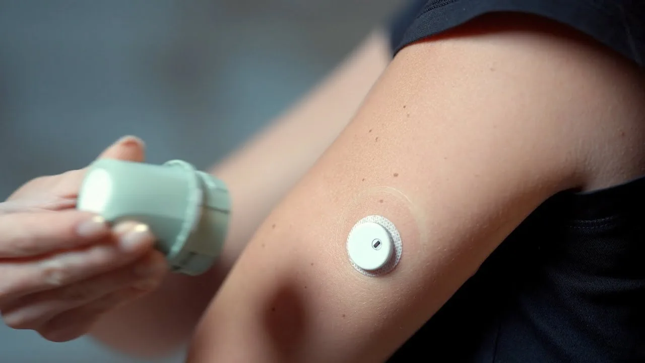 A LinX sensor on the back of the upper arm, applicator still in hand